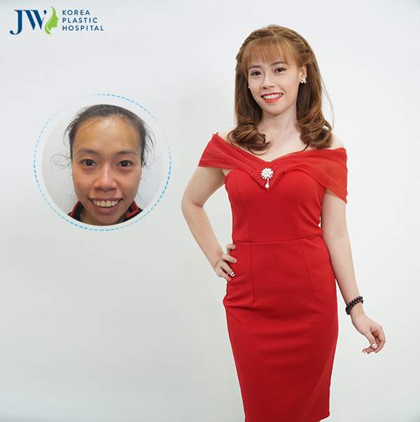 Lộ diện 10 gương mặt tại đại hội vinh danh người đẹp thẩm mỹ JW 5