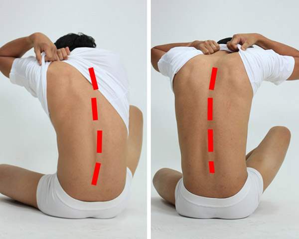 10 cách giảm đau lưng hiệu quả mà chẳng cần đến 1 viên thuốc 5