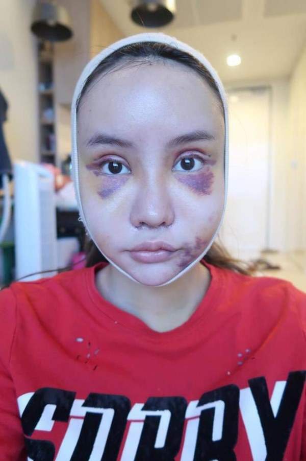 Cô gái Thái "đập mặt xây lại" chịu đau đớn hàng tháng trời 4