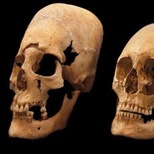 Vì sao phụ nữ Trung cổ có hộp sọ giống người ngoài hành tinh? 6