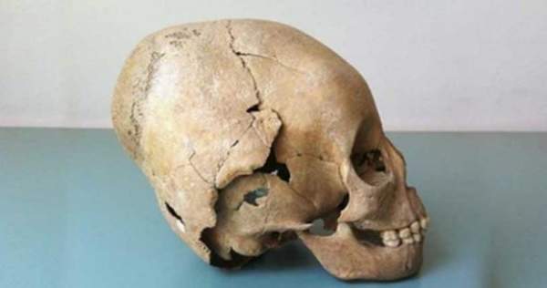 Vì sao phụ nữ Trung cổ có hộp sọ giống người ngoài hành tinh? 9
