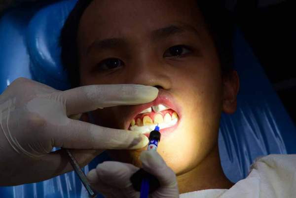 Các bác sĩ nha khoa Hàn Quốc khám chữa răng miễn phí cho trẻ mồ côi 5