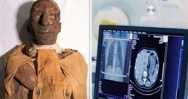 Chụp cắt lớp xác ướp pharaoh Ai Cập 3.000 tuổi, phát hiện bí mật choáng váng 2