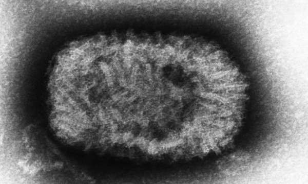 Những loại virus nguy hiểm trên Trái Đất 5
