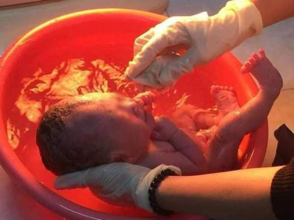 Bé trai chào đời với 6 vòng dây rốn quấn cổ và bụng, bác sĩ kinh ngạc: Quá đặc biệt! 4