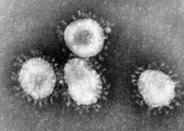 Người phụ nữ phát hiện virus corona đầu tiên trên cơ thể người vào năm 1964 2