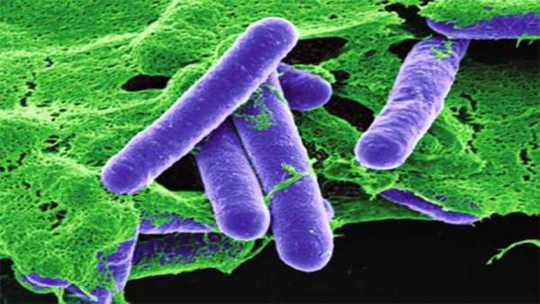 Vi khuẩn Clostridium botulinum: Nguyên nhân, triệu chứng và cách phòng ngừa