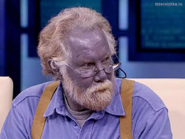 Gia tộc Fugate: "Những người ngoài hành tinh" với làn da xanh bị cô lập với thế giới hàng trăm năm 2