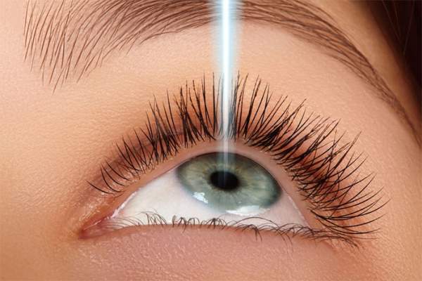 Những nguyên nhân gây tái cận sau mổ mắt 3