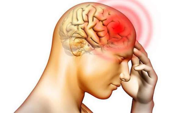 Bệnh phù não: Nguyên nhân, triệu chứng và cách điều trị 2