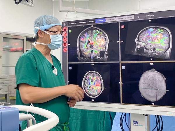 Một bệnh viện ở Việt Nam mổ não tỉnh thức bằng robot AI: bệnh nhân hát trong lúc đang mổ! 1