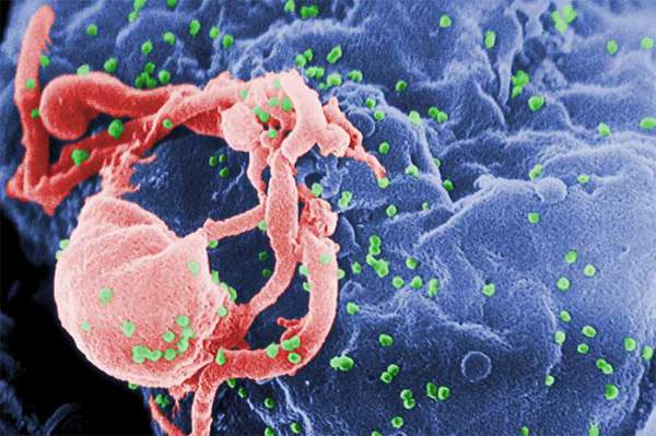 Các nhà khoa học phát hiện ra một tập hợp biến thể di truyền dường như có thể hạn chế lây nhiễm HIV 2