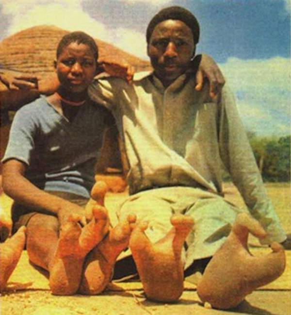 Bộ lạc “chân đà điểu“ kỳ lạ ở châu Phi 5