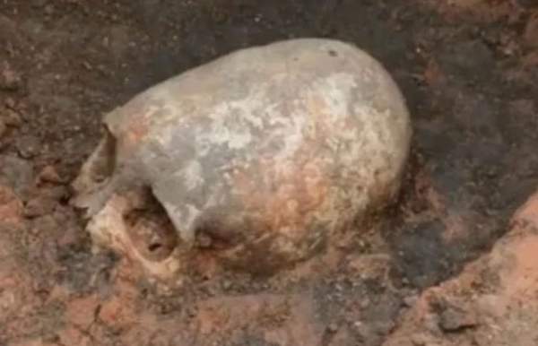 Các hộp sọ khai quật ở Thổ Nhĩ Kỳ có dấu vết "phẫu thuật sọ não" 3.200 năm trước