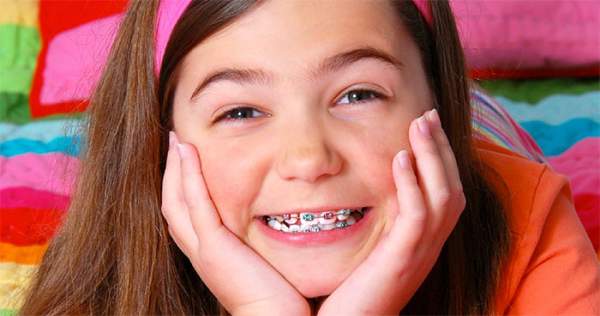 Bác sĩ chỉ ra thời điểm vàng nên bắt đầu chỉnh nha tăng trưởng và điều trị các vấn đề về răng cho trẻ 2