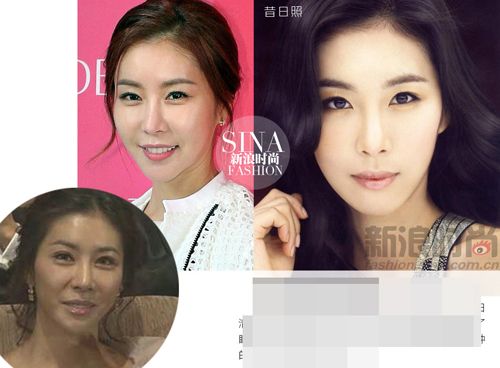 Khuôn mặt méo mó bất thường của sao nữ Hàn Quốc 6