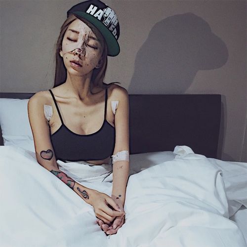 DJ sexy nhất Malaysia tung ảnh phẫu thuật đau đớn 8