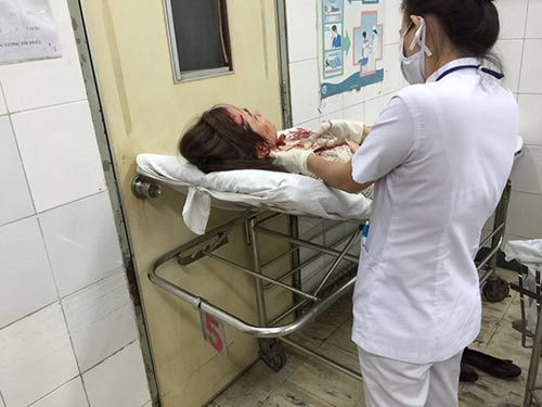 Vợ mới cưới của Huỳnh Đông bị tai nạn xe hơi phải nhập viện 3