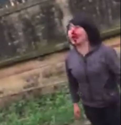 Đau lòng clip nữ sinh bị đánh tới bầm dập mặt mũi 3
