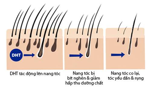 Nguyên nhân và giải pháp chữa trị rụng tóc 3