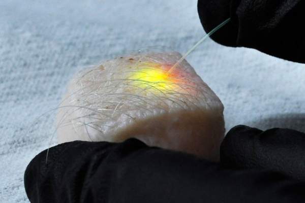 Các nhà khoa học tìm thấy 3 cách biến tế bào con người thành tia laser 2