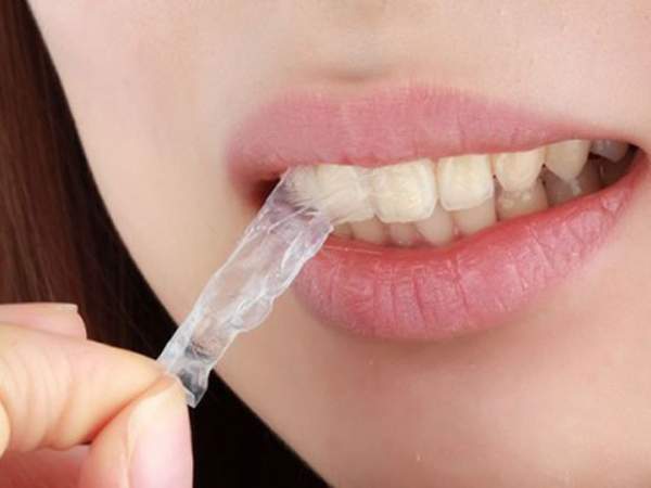 Lợi và hại khi dùng miếng dán trắng răng cấp tốc sau 1 tuần 3