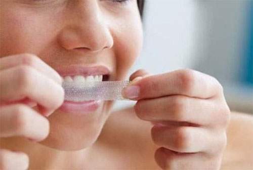 Lợi và hại khi dùng miếng dán trắng răng cấp tốc sau 1 tuần 6