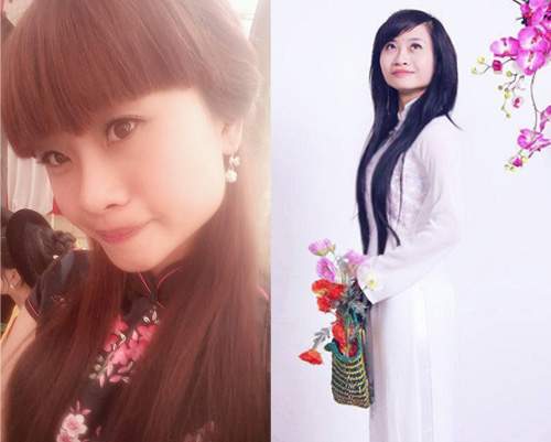 Nghe cô gái Việt kể chuyện phẫu thuật gọt mặt 9