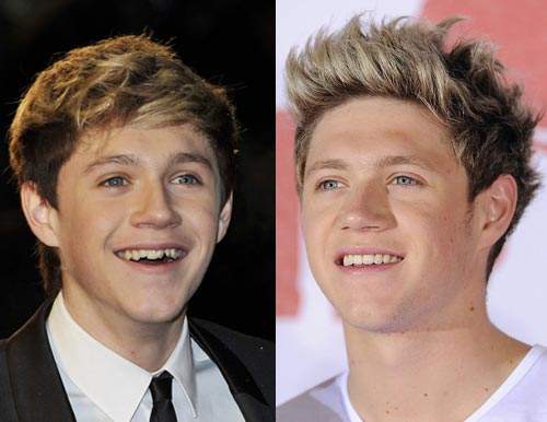 Nhan sắc người nổi tiếng trước và sau khi sửa răng 15