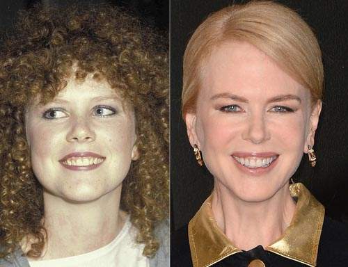 Nhan sắc người nổi tiếng trước và sau khi sửa răng 24