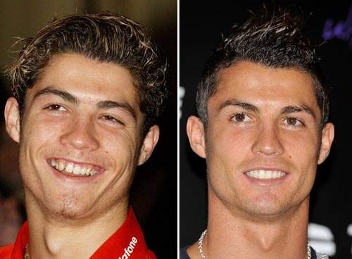 Nhan sắc người nổi tiếng trước và sau khi sửa răng 21