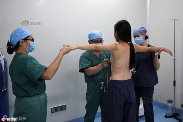 Siêu mẫu Trung Quốc công khai ảnh thẩm mỹ "sửa nát mặt" 24