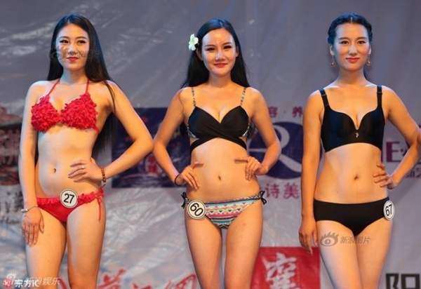 Siêu mẫu Trung Quốc công khai ảnh thẩm mỹ "sửa nát mặt" 9