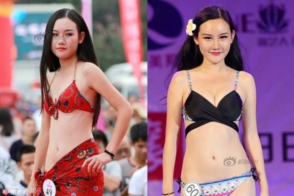Siêu mẫu Trung Quốc công khai ảnh thẩm mỹ "sửa nát mặt" 6