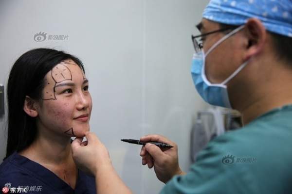 Siêu mẫu Trung Quốc công khai ảnh thẩm mỹ "sửa nát mặt" 15