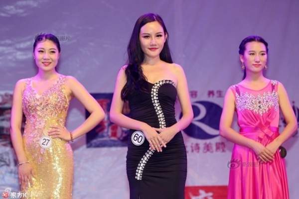 Siêu mẫu Trung Quốc công khai ảnh thẩm mỹ "sửa nát mặt" 3