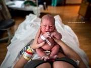 Ca sinh em bé bị dây rốn siết chặt méo bụng khiến bác sĩ kinh ngạc 42