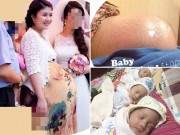 Mẹ trẻ Hà Nội mang thai 3 hiếm gặp mà cả thế giới 200 triệu ca mới có một 29