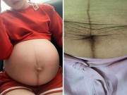 Mẹ Việt sinh con ở Úc: Đẻ xong vào tắm liền, uống nước đá để đỡ đau vết rạch 29