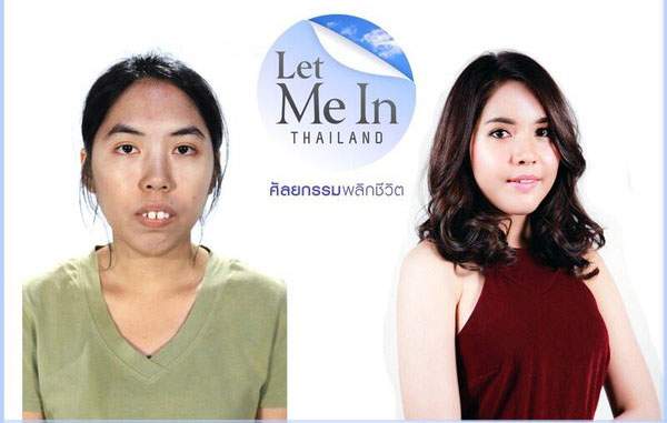 Vỡ mộng với "mặt gốc" không như là mơ của loạt mỹ nam, mỹ nữ Thái 9