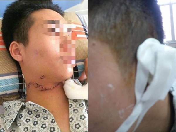 Thanh niên bị kính ô tô cứa cổ sau va chạm khủng khiếp 4