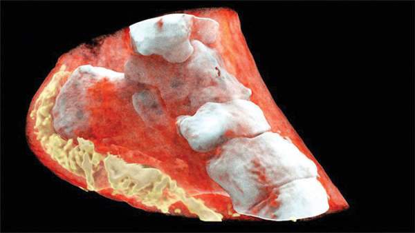 Đây là hình ảnh X-quang màu 3D đầu tiên trên thế giới, đừng xem nếu bạn yếu tim 2