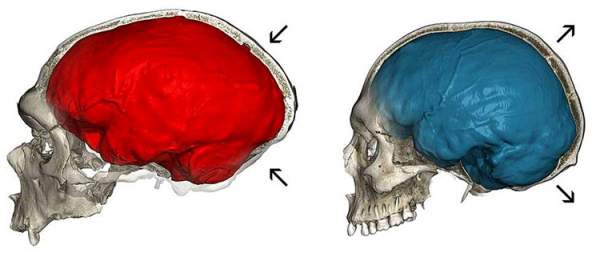 Những người đầu hơi bẹp là do gene di truyền của người Neanderthal 2