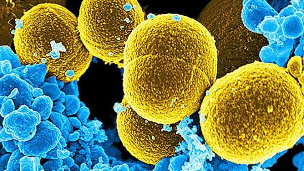 7 loại vi khuẩn kháng thuốc nguy hiểm 2