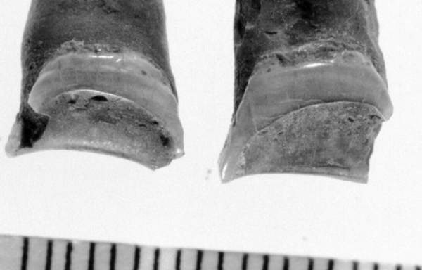 Chiếc răng 4000 năm tuổi trả lời cho câu hỏi: Người cổ đại từng làm nghề gì? 2