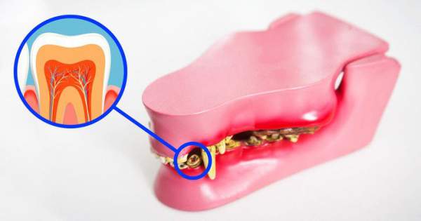 Các nhà khoa học đã tìm ra cách giúp bạn mọc lại răng mới chỉ sau 2 tháng 2
