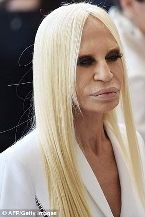 Sốc với gương mặt bất thường của "bà trùm" Versace 5