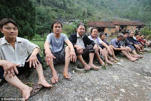 Dân làng Trung Quốc nhiễm bệnh lạ không thuốc chữa 4