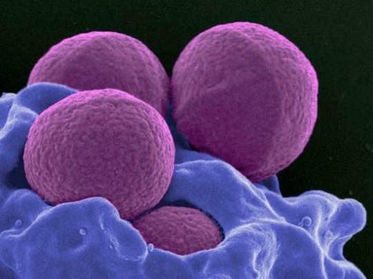 Số người chết vì siêu vi khuẩn sẽ vượt ung thư