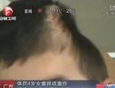 Clip “bé trai bị bạo hành tại Trung Quốc” khiến người dùng Internet phẫn nộ